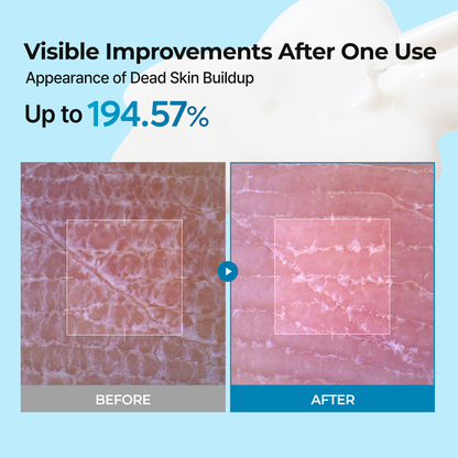 Peel Shot Exfoliating TX Serum