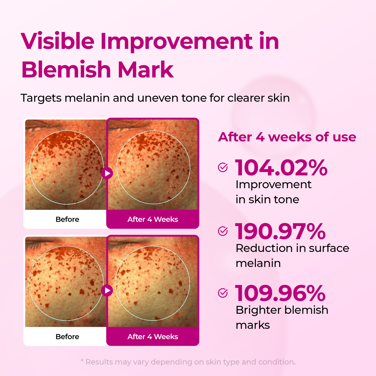 [TikTok Bestseller] Lumi Pore & Spot Care Duo